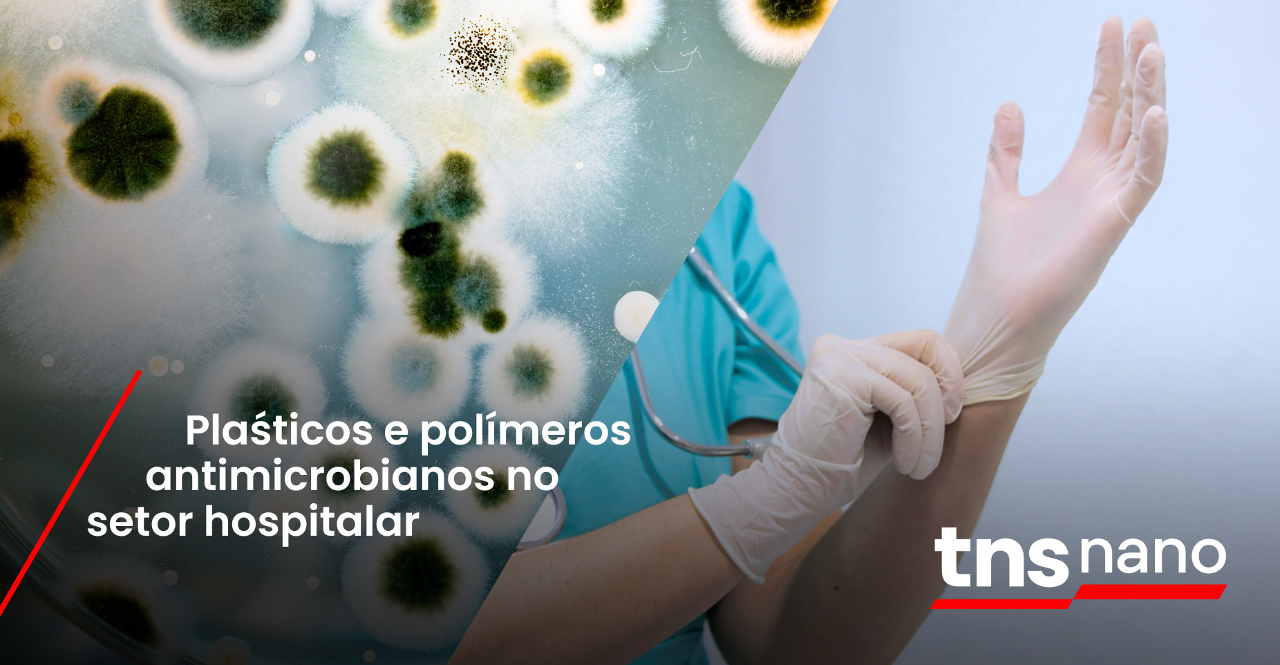 [TNS Nano] Soluções para setor hospitalar